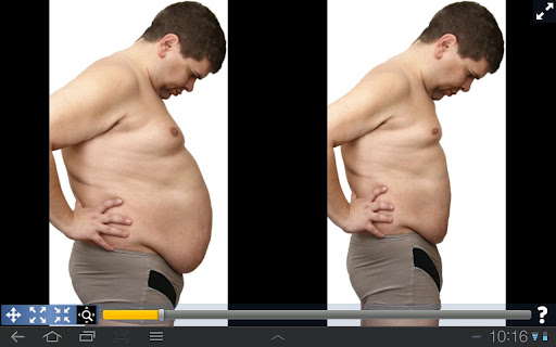 Plastic Surgery Simulator
