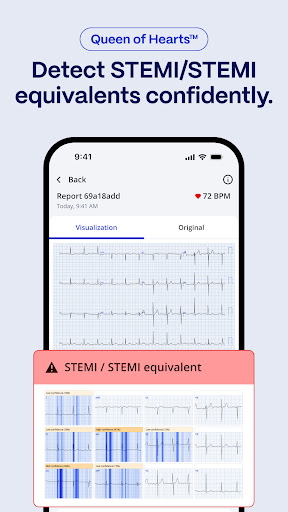 PMcardio for Individuals