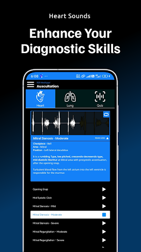 Auscultation | Heart Sounds
