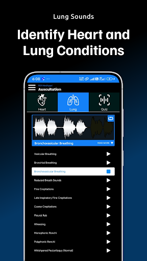 Auscultation | Heart Sounds