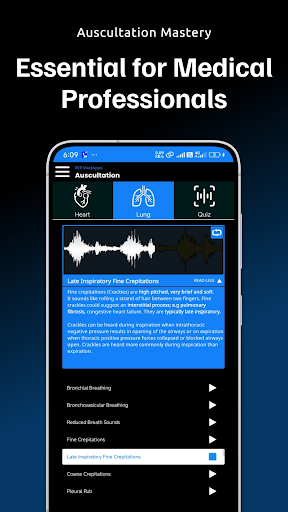 Auscultation | Heart Sounds