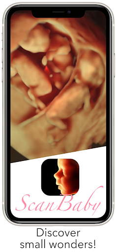 ScanBaby learn baby ultrasound