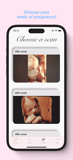 ScanBaby learn baby ultrasound