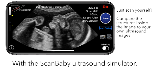 ScanBaby learn baby ultrasound