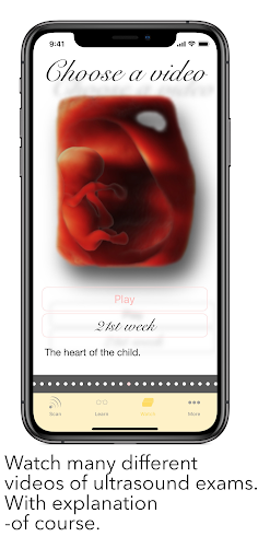 ScanBaby learn baby ultrasound