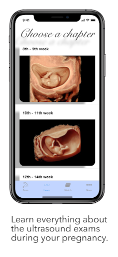 ScanBaby learn baby ultrasound