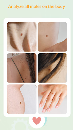 Medic Scanner – skin analyze