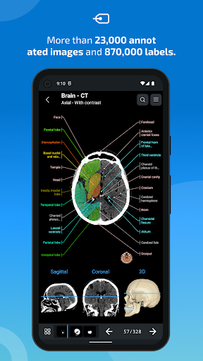 IMAIOS e-Anatomy