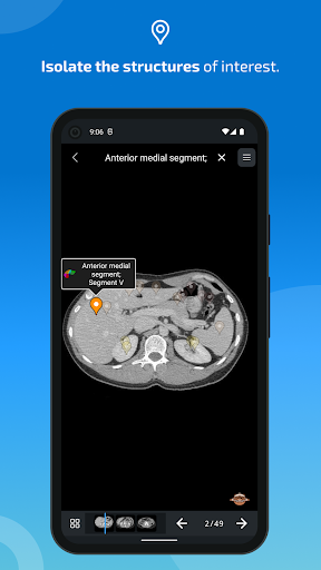 IMAIOS e-Anatomy